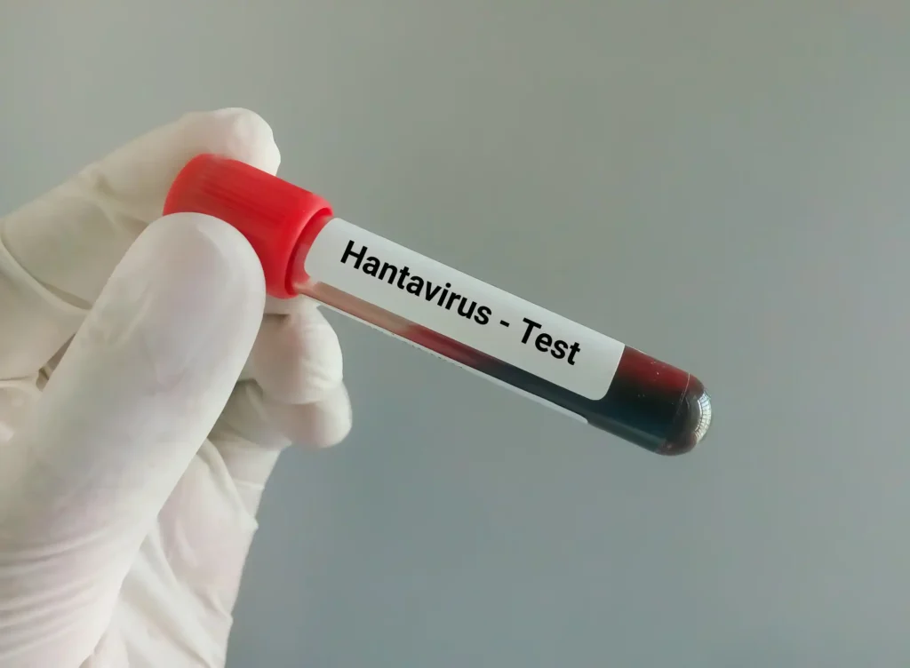 Hantavirus en crucero MV Hondius: ¿Qué implica el brote para España y Canarias?