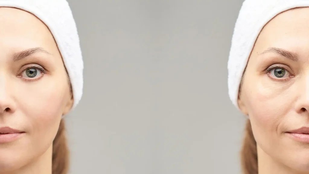 La Influencia del Cortisol en la Salud Facial y Hormonal